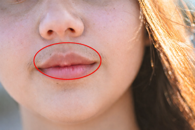 Szőrösödés, kellemetlen testszag, álmatlanság? 8 gyanús jel nőknél, ami komoly betegségre utal!