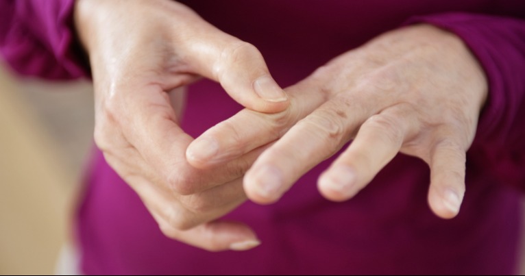 Így jelenik meg a kézfejen a rák – Hónapokkal előbb figyelmeztetnek