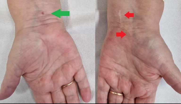 Meglepő, mi állhat a kéz- és ízületi fájdalom hátterében – Sokan elrontják